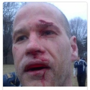 Sunday, Bloody Sunday